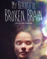 Phim Khối óc xinh đẹp tội nghiệp của tôi - My Beautiful Broken Brain (2016)
